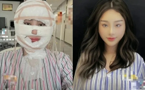 Lâm Khánh Chi từng cho biết cô thực hiện trùng tu nhan sắc vì bạn trai