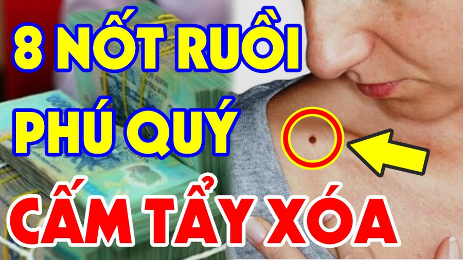 not ruoi