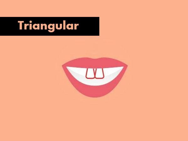 nhin tuong rang 2