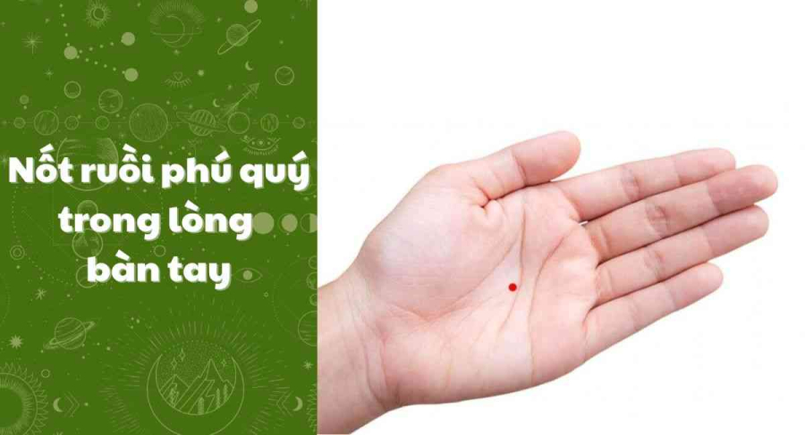 not-ruoi-phu-quy-trong-long-ban-tay