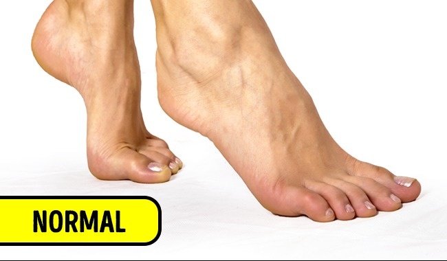 su tic nuoc