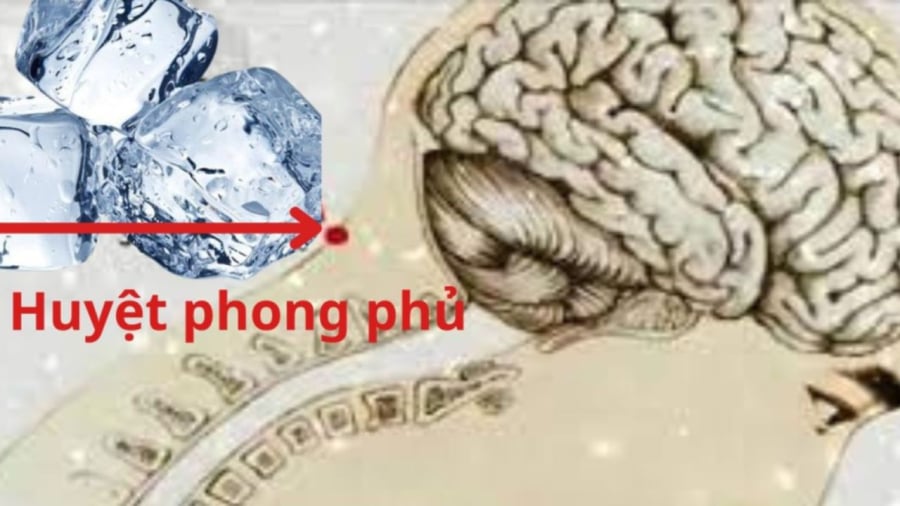 Đá lạnh đặt ở huyệt phong phủ giúp ngủ ngon hơn