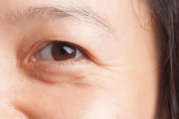 Những thói quen xấu làm tăng khả năng xuất hiện vết chân chim sớm hơn.
