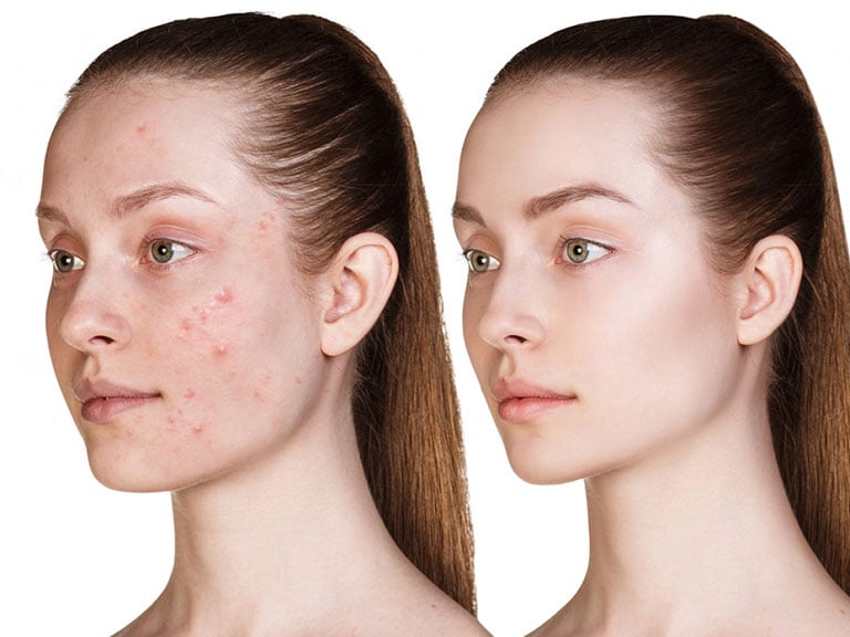 Các bước skincare tiết kiệm thời gian, đồng thời nâng cao hiệu quả. 