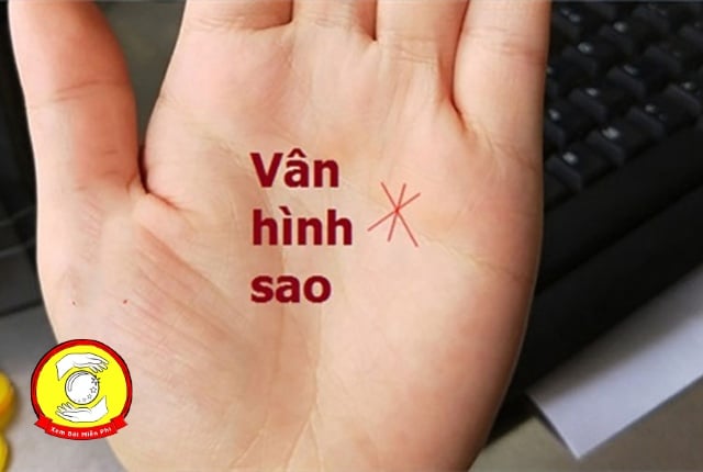 Lòng bàn tay có vân hình sao    