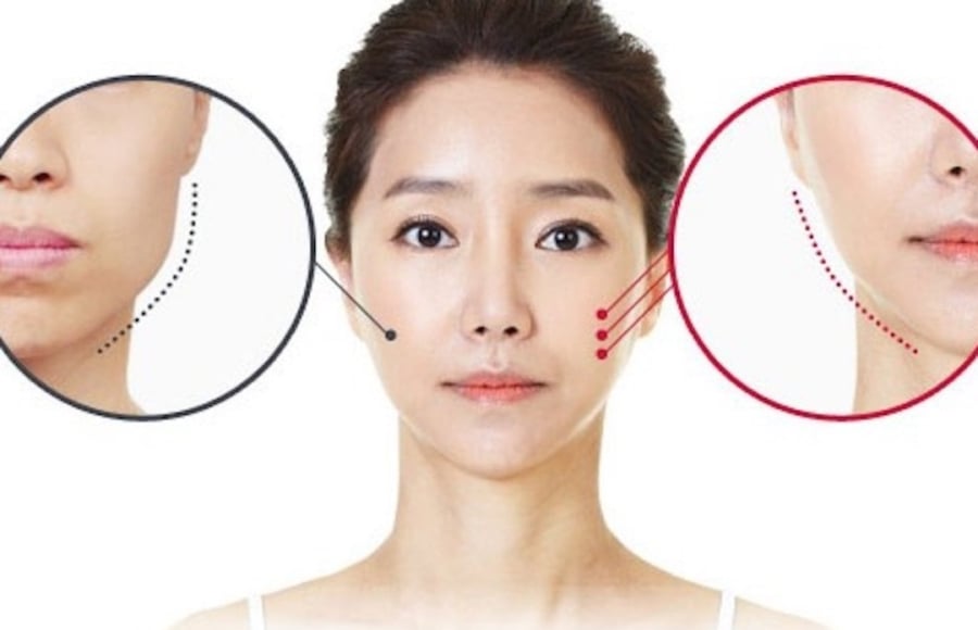 Mặt trái xoan là gương mặt có ngũ quan cân đối, đường nét hài hòa