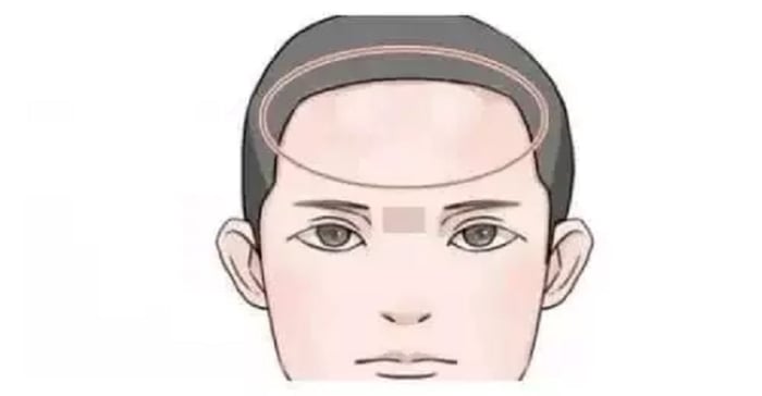 Người có vầng trán đầy đặn thường thông minh, phúc khí dồi dào. 