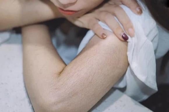 Phụ nữ có nhiều lông tay được cho là nét tướng tốt.