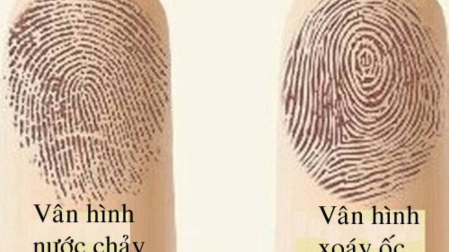 Nhìn vào các ngón tay của bạn và tìm kiếm những vòng tròn nổi bật hoặc các đường xoắc ốc