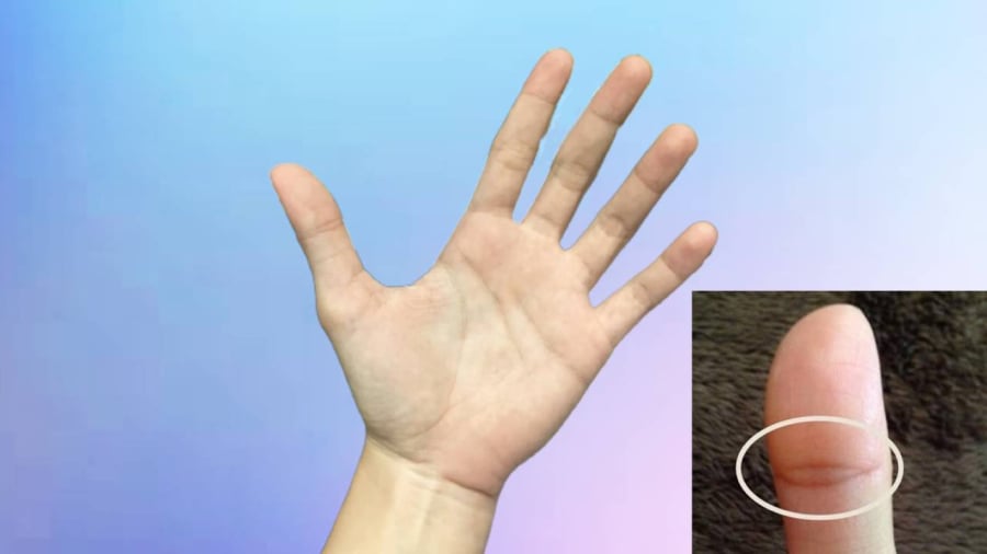 Chỉ cần nhìn ngón tay cái cũng biết vận mệnh một người?