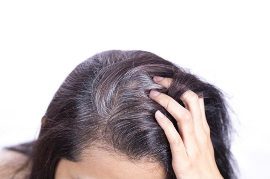 Khi tóc bạc xuất hiện, đừng quá lo lắng, nếu bạn luôn quan tâm đến tóc bạc của mình, tâm trạng của bạn sẽ bị ảnh hưởng, không có lợi cho việc xuất hiện tóc đen. 