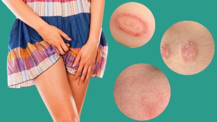 Ngứa vùng kín có rất nhiều nguyên nhân, nhưng chủ yếu là do 5 nguyên nhân này. (Ảnh minh họa)