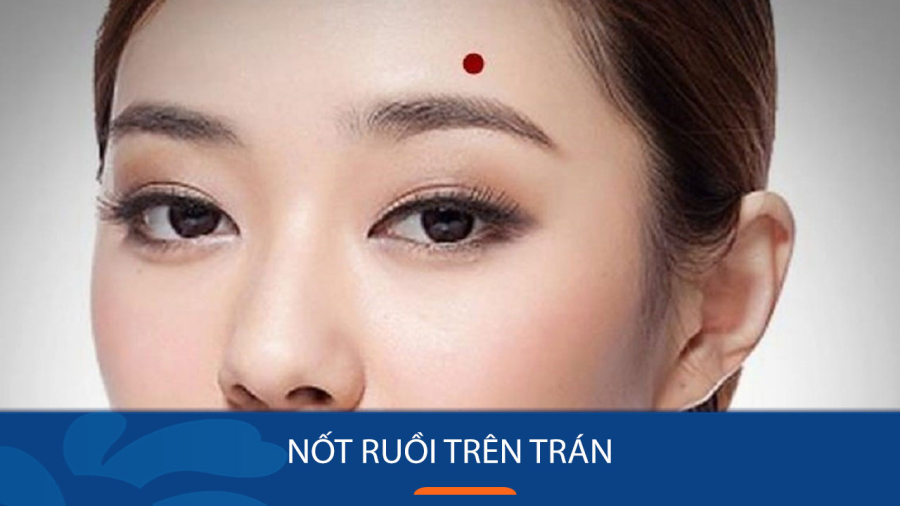 Phụ nữ có nốt ruồi ở trán không chỉ sinh ra đã có phúc khí mà còn mang đến vận khí tốt cho cả Shbet111 slot, casino, thể thao, xổ số, nốt ruồi ở trán thuộc nốt ruồi tài lộc.