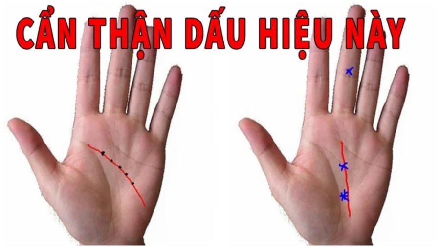 Tướng bàn tay nghèo khổ phúc mỏng phận bạc