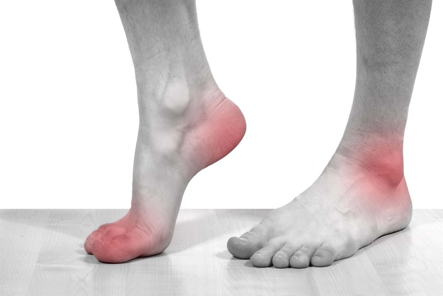 Cảnh báo bệnh từ bàn chân nên đi khám