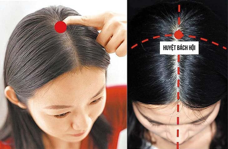 Huyệt Bách hội