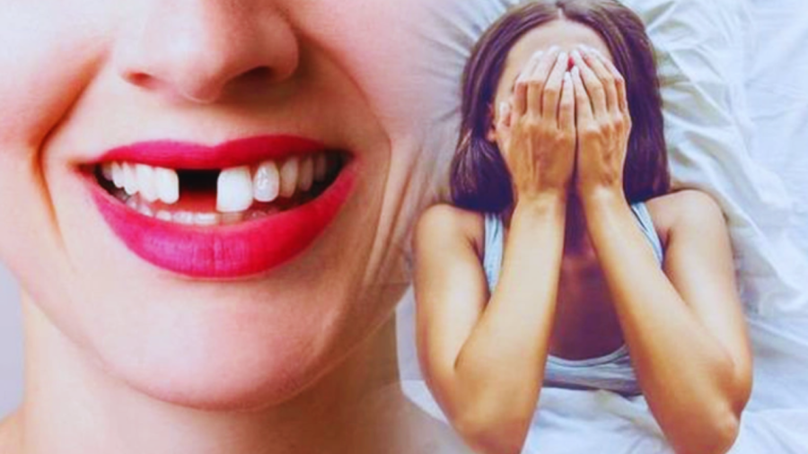 Mơ ngủ bị rụng răng là điềm báo lành hay dữ?