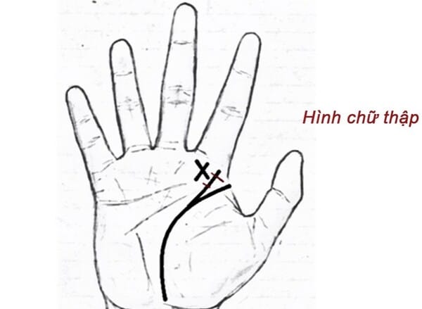 Gò Thái Dương gồ lên, có hình chữ thập hoặc vân ngôi sao    