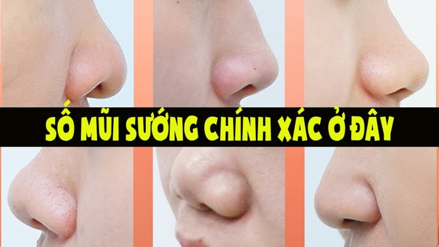Tướng mũi
