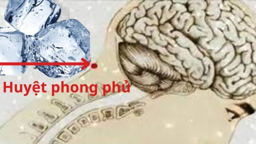 Đặt đá lên huyệt phong phủ giúp ngủ ngon hơn