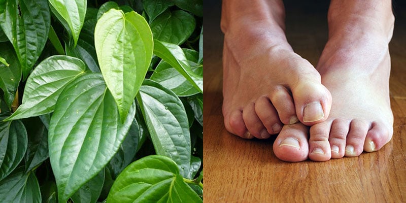 Hôi chân là một trong những căn bệnh khiến bạn luôn cảm thấy khó chịu, mất tự tin. 