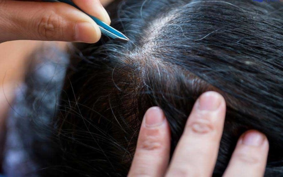 Nhổ tóc bạc để lại những nguy hại khôn lường, da đầu và nang tóc bị tổn thương khiến...