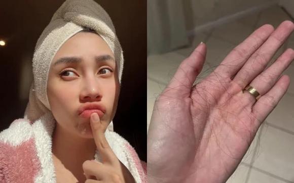 Võ Hoàng Yến cho biết bản thân bị rụng tóc nhiều khi mang thai  