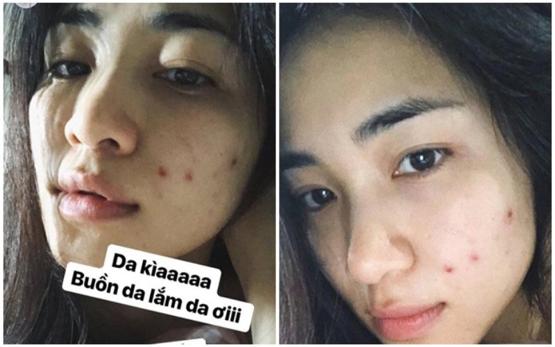 Hoà Minzy uống nước diếp cá cải thiện Mừng SHBET phiên bản mới 2025 nhiều mụn.