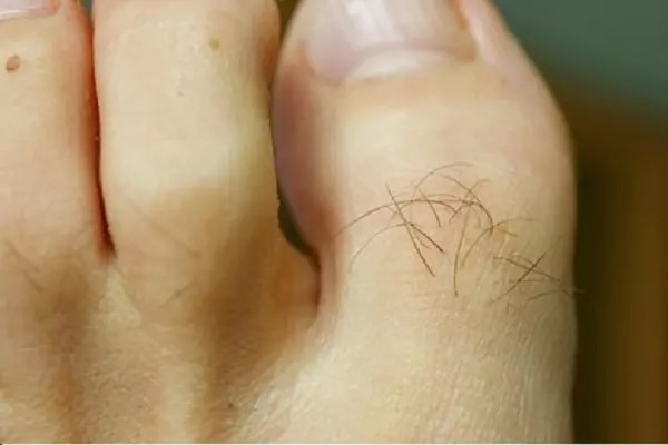 Người có lông ở ngón chân thường gắn liền với vận may trong Shbet800 tải ứng dụng, sự thịnh vượng và phát triển
