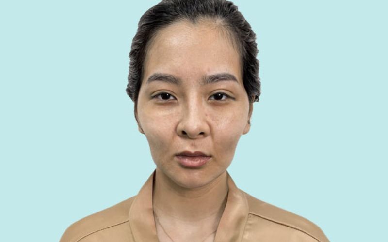 Mặt gầy, gò má cao số phận khó nhọc