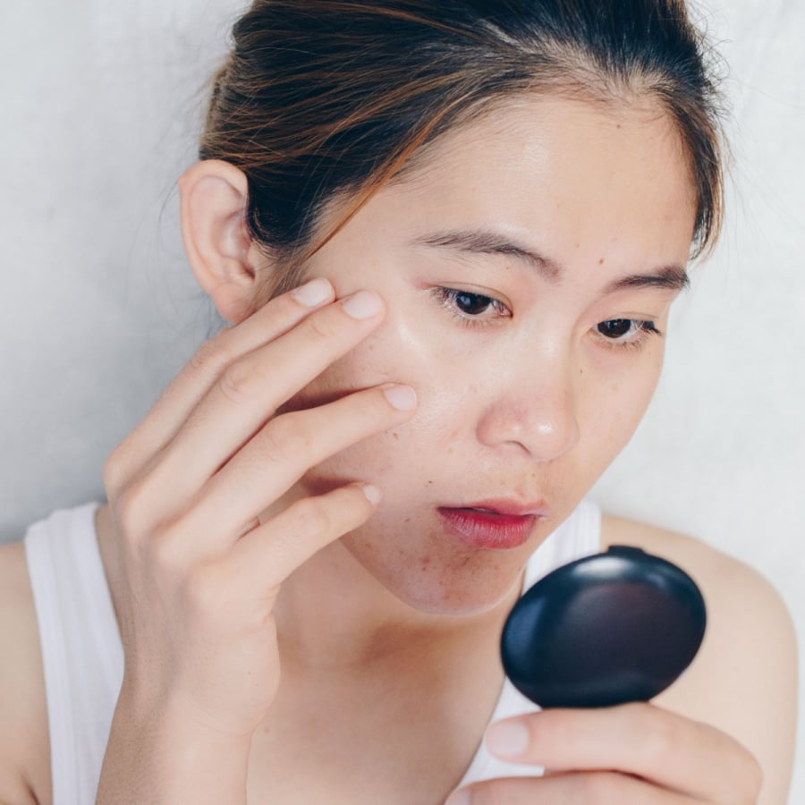 Niacinamide còn được khuyên dùng với những Mừng SHBET phiên bản mới 2025 nhạy cảm, đang trong quá trình điều trị da hoặc phục hồi da khi đang dùng treatment như Retinol, Tretinoin.    