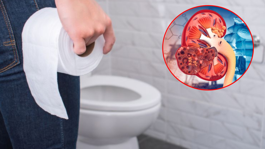 Bệnh thận có thể diễn tiến trong âm thầm. Khi thấy một số dấu hiệu bất thường như Sh88bet đăng ký miễn phí hay bị phù nề, tiểu đêm nhiều lần, bạn nên đi kiểm tra sức khỏe.
