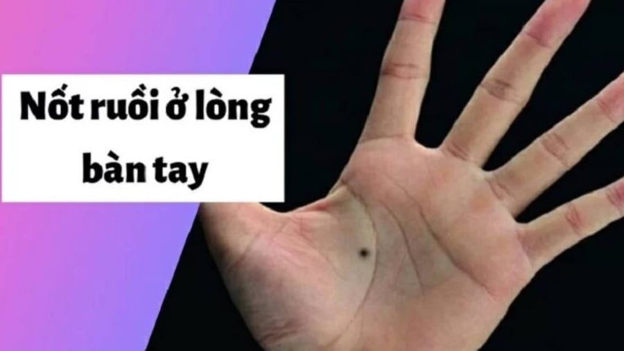 Trong nhân tướng học, nốt ruồi trong lòng bàn tay được gọi là nốt ruồi giữ của 