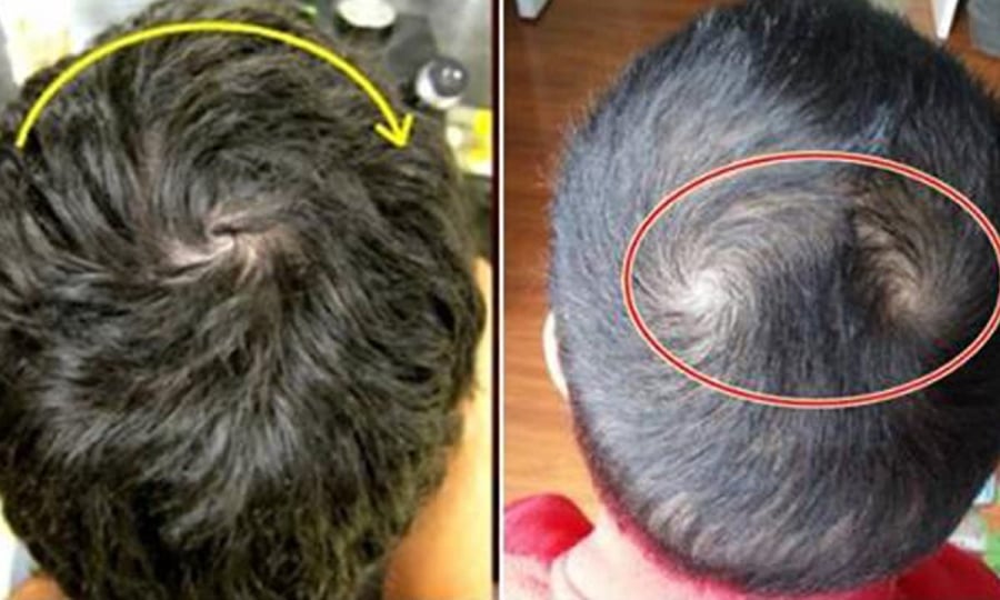 Những người có 2 hoặc 3 xoáy tóc trên đầu tự tin, mạnh mẽ nhưng cũng khá bướng bỉnh, luôn làm theo ý mình. 