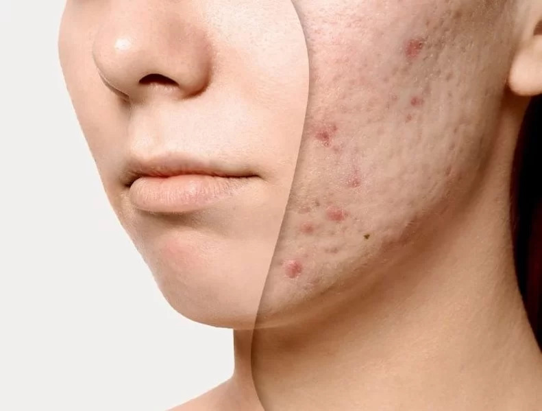 Tẩy tế bào chết bằng cà phê tốt để làm da sáng mịn hơn. 