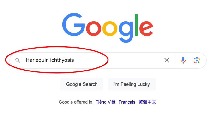 Harlequin ichthyosis là một từ khoá mà bạn không nên tìm kiếm trên Google.