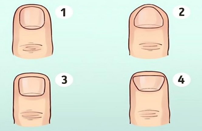 Nhìn hình dáng móng tay biết tương lai