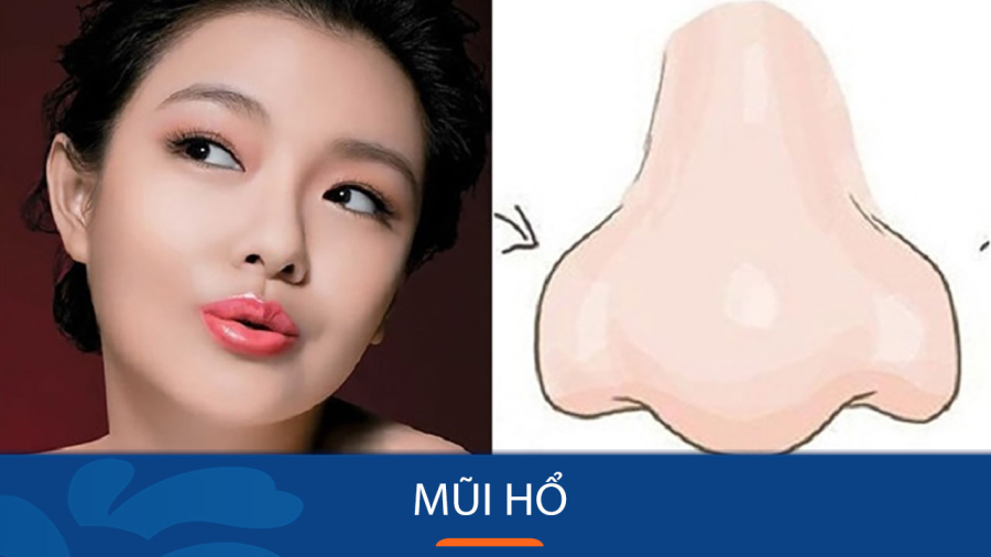 Nhìn tướng mũi biết tương lai