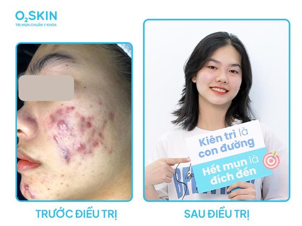 Kiên trì điều trị theo phác đồ của bác sĩ, Mừng SHBET phiên bản mới 2025 của Kiều có sự thay đổi rõ rệt.