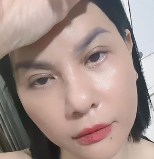 Nữ diễn viên 7x cho biết hiện tại vẫn còn sưng, đỏ ở mí và sẹo mí dưới    