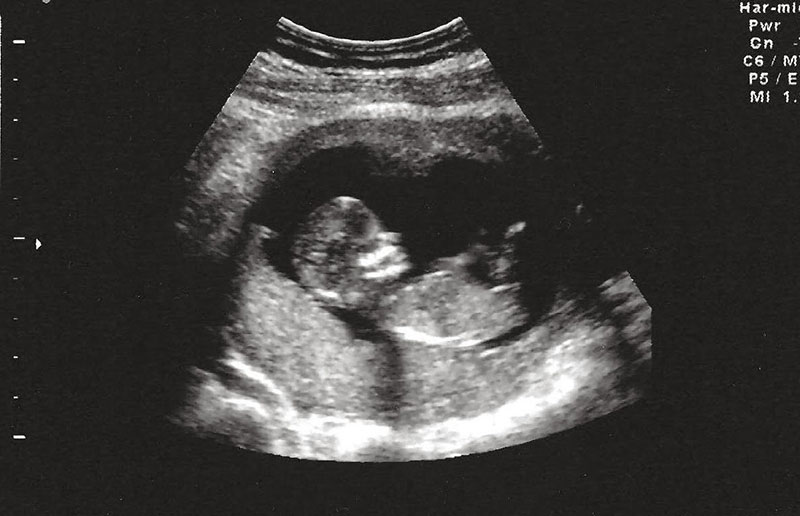 Sự vui mừng khi có con là điều dễ hiểu, nhưng việc đăng ảnh siêu âm của thai nhi lên mạng xã hội không phải là lựa chọn tốt nhất.