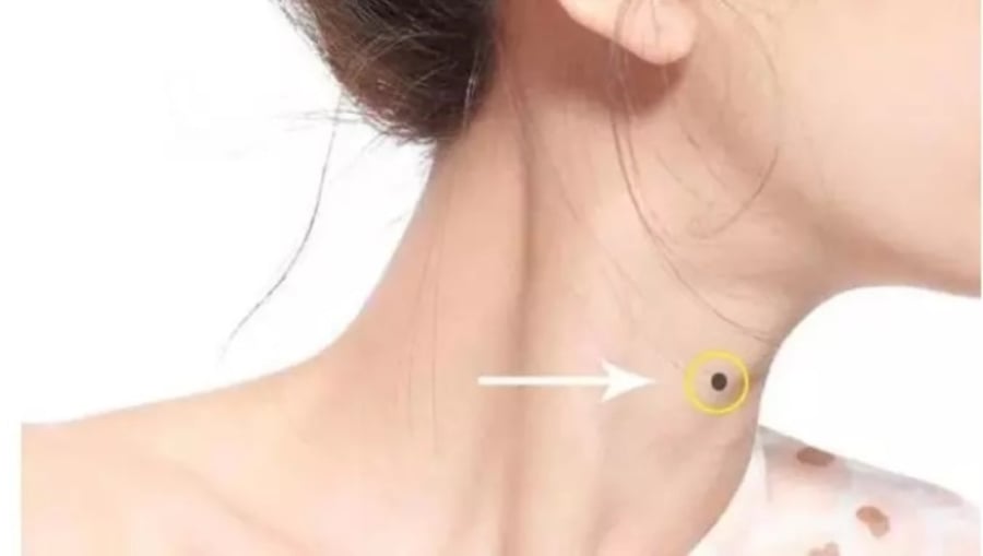 Người phụ nữ có nốt ruồi trên cổ. (Ảnh minh họa)
