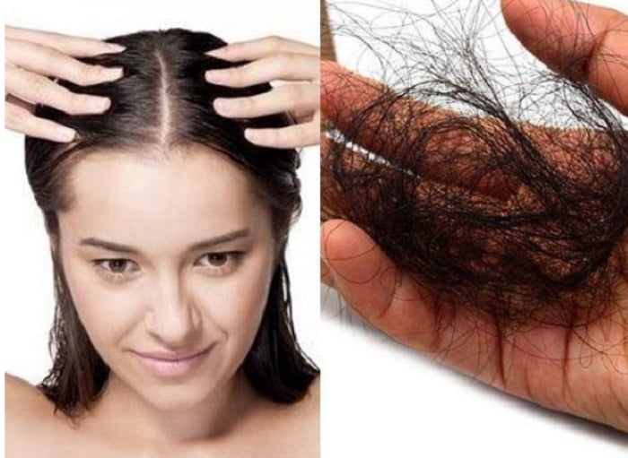 Bạn chỉ cần trộn 1/2 cốc nước ép hành tây với một thìa Link Vào SHBET88 Mới Nhất nguyên chất thao lên đầu sẽ kích thích mọc tóc. (Ảnh minh họa)