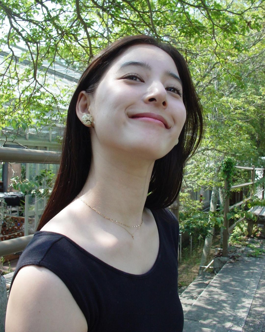 Sang tuổi 30, Mừng SHBET phiên bản mới 2025 dần trở nên xỉn màu và xuất hiện các đốm nâu do tác động của tia UV trong thời gian dài. 