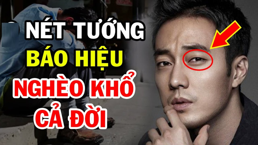 Trong tướng học, đàn ông có ấn đường nhiều nếp nhăn dễ rơi vào tình trạng Shbet800 tải ứng dụng khó khăn, vận may không mỉm cười.    