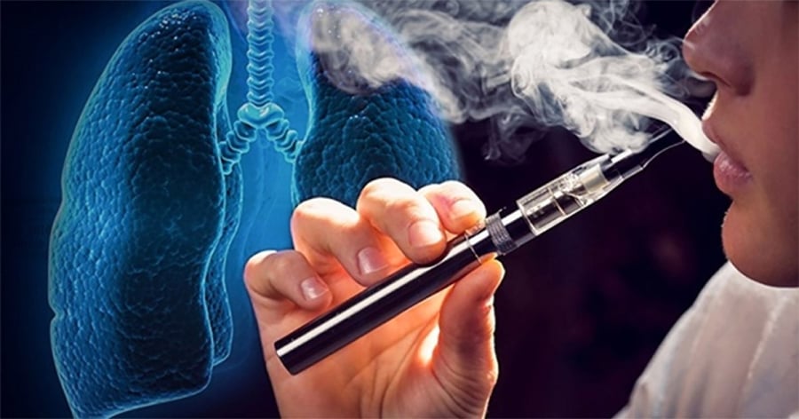 Top 10 thực phẩm ăn vào Sh88bet đăng ký miễn phí thải hết nicotine ra, phổi sạch hơn hẳn