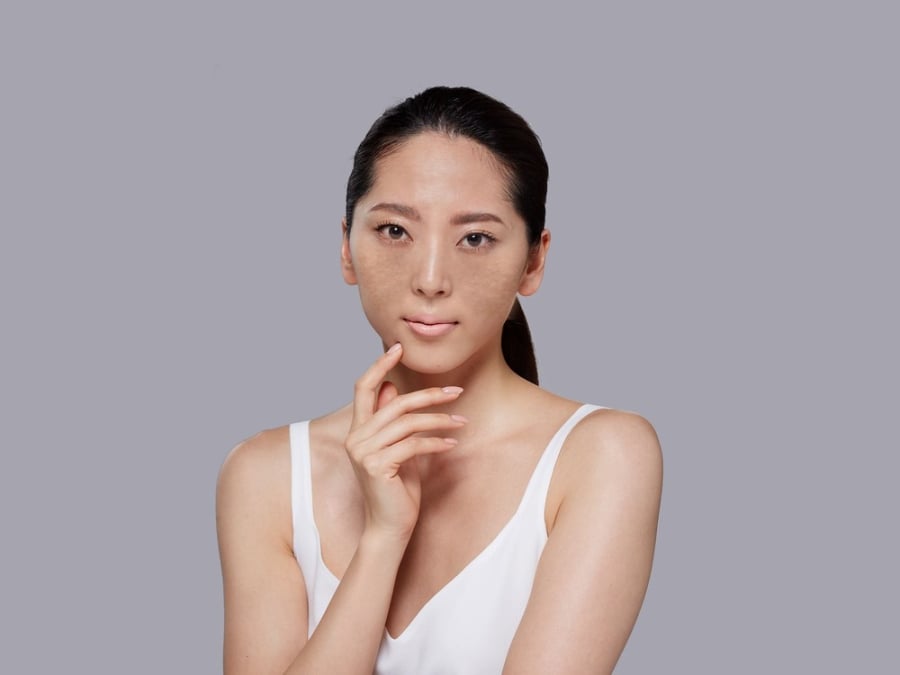 Chế độ ăn uống, sinh hoạt thiếu khoa học sẽ khiến da xuống cấp rõ rệt sau một thời gian.  