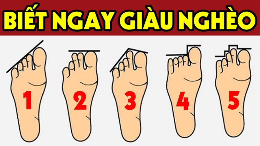 Bàn chân giàu có