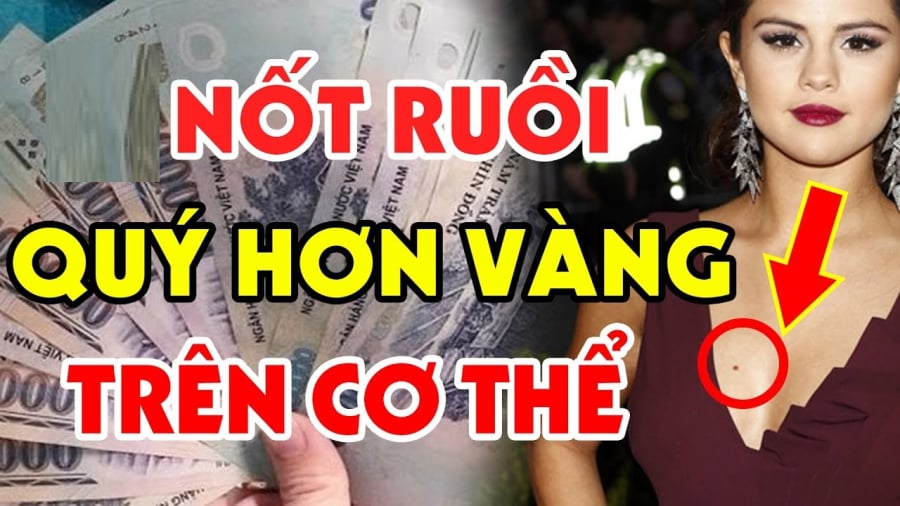 Xem tướng nốt ruồi trên Sh88bet đăng ký miễn phí cũng đoán định được vận số tương lai