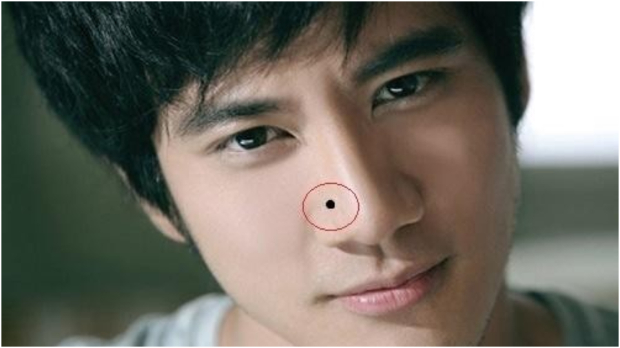 Nốt ruồi hút lộc 
